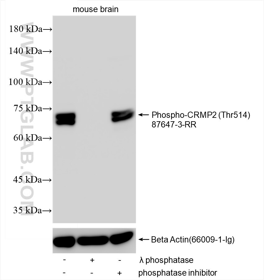 WB analysis using 87647-3-RR (same clone as 87647-3-PBS) Western Blot (WB) analysis of various lysates using Phospho-CRMP2 (Thr514) Recombinant monoclonal anti (87647-3-RR)