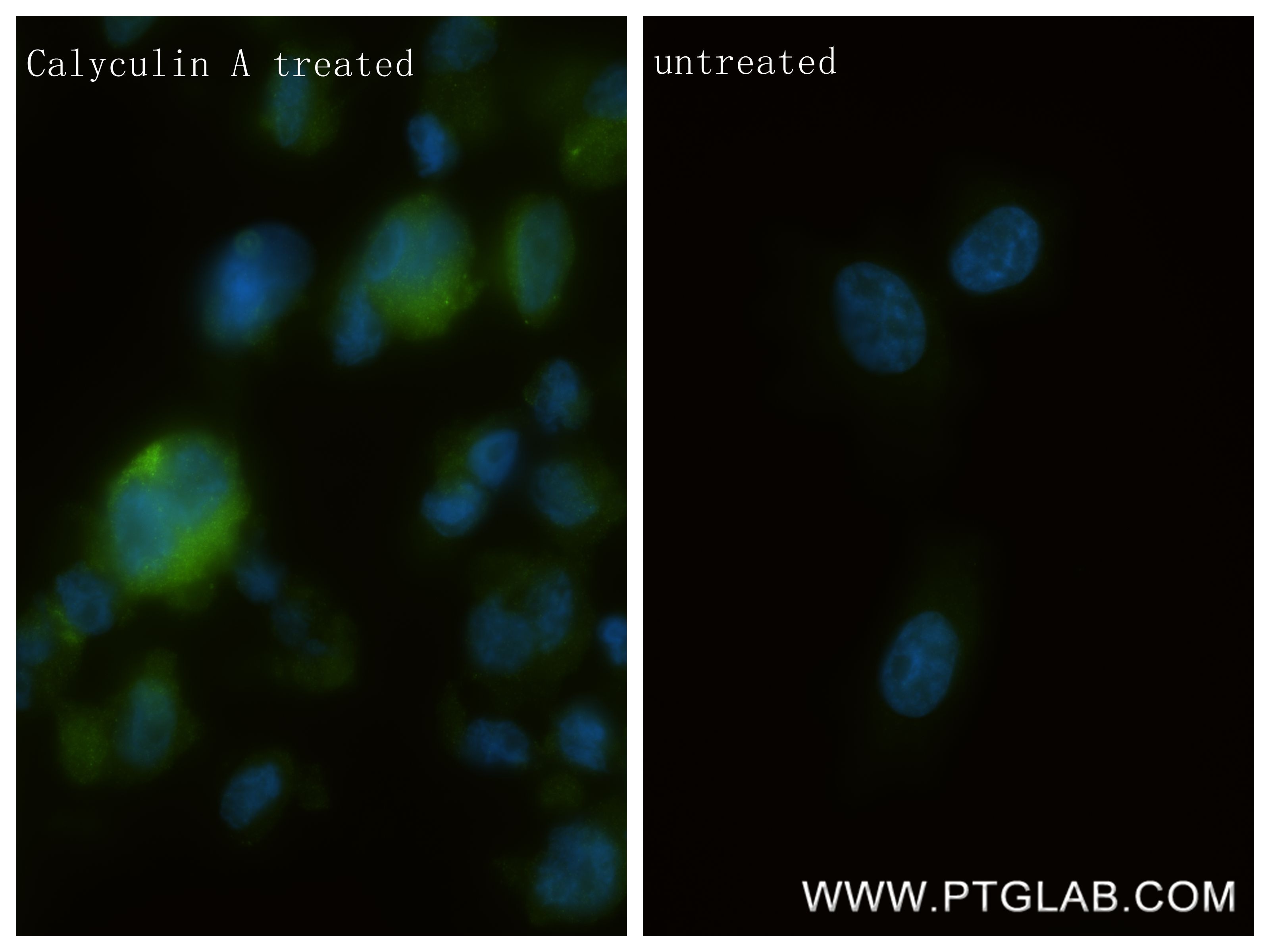 Immunofluorescence (IF) / fluorescent staining of PC-3 cells using Phospho-Beta Catenin (Ser33) Recombinant monoclona (80067-1-RR)
