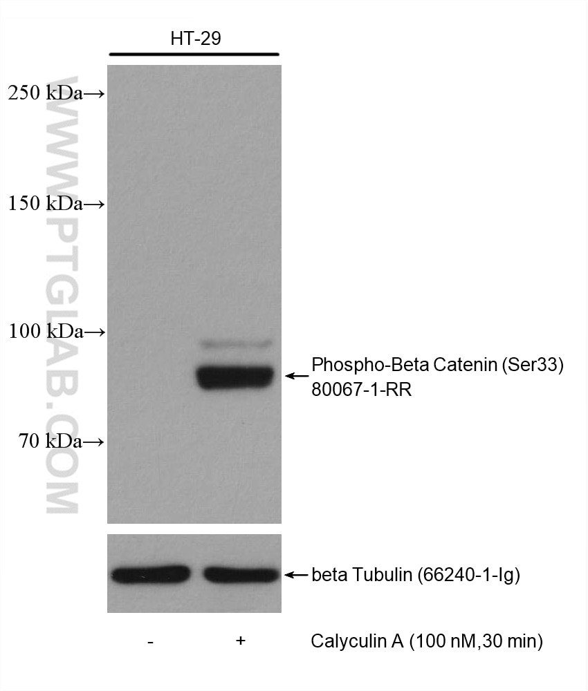 Western Blot (WB) analysis of various lysates using Phospho-Beta Catenin (Ser33) Recombinant antibody (80067-1-RR)