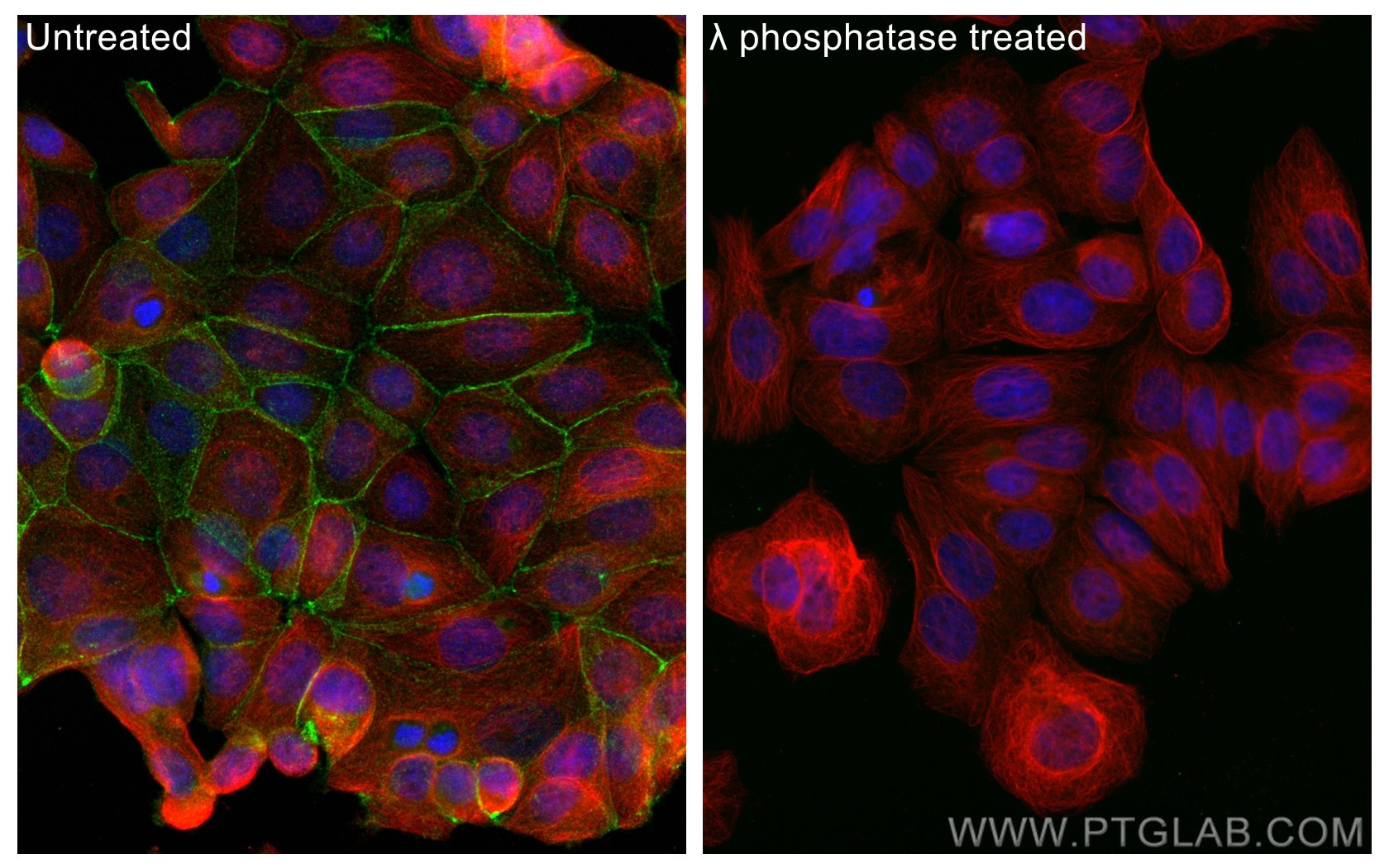 Immunofluorescence (IF) / fluorescent staining of MCF-7 cells using Phospho-Beta Catenin (Ser675) Recombinant antibody (80084-1-RR)