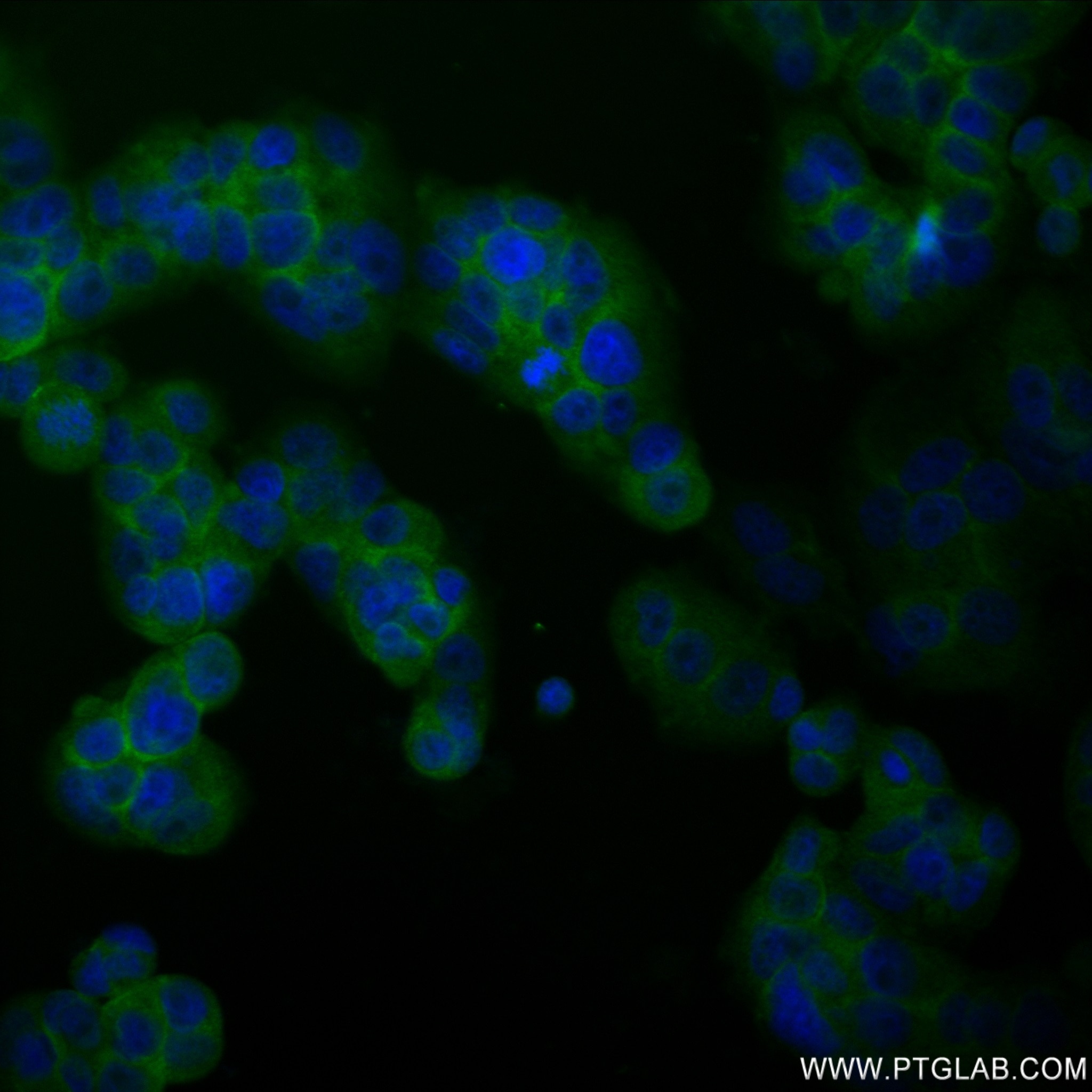 Immunofluorescence (IF) / fluorescent staining of MCF-7 cells using Phospho-Beta Catenin (Ser675) Recombinant antibody (80084-1-RR)