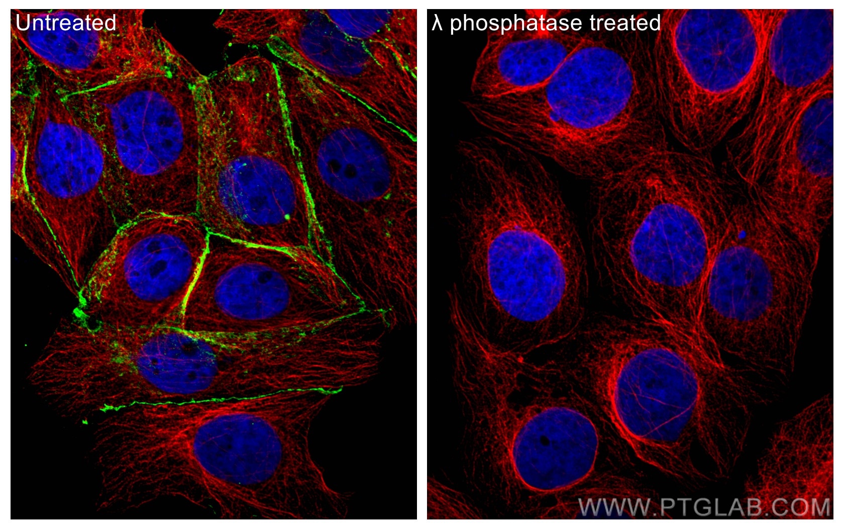 Immunofluorescence (IF) / fluorescent staining of MCF-7 cells using Phospho-Beta Catenin (Ser675) Recombinant antibody (80084-1-RR)