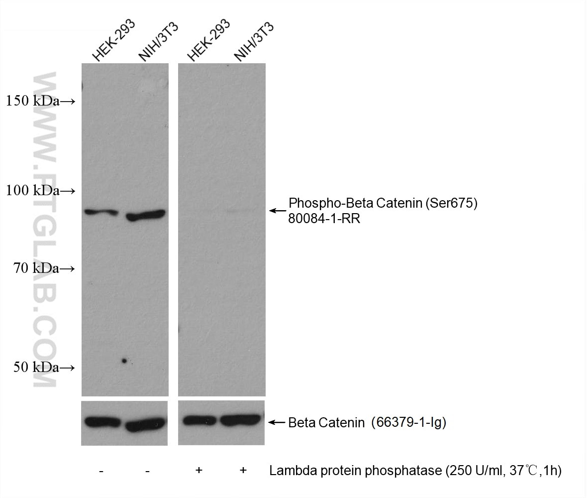 Western Blot (WB) analysis of various lysates using Phospho-Beta Catenin (Ser675) Recombinant antibody (80084-1-RR)