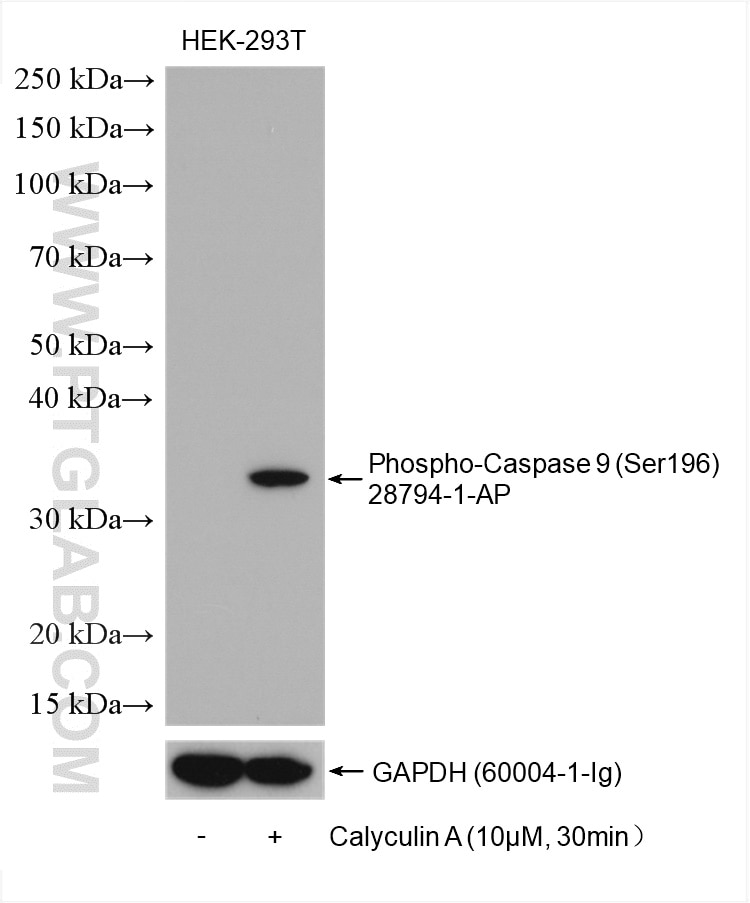 Western Blot (WB) analysis of various lysates using Phospho-Caspase 9 (Ser196) Polyclonal antibody (28794-1-AP)