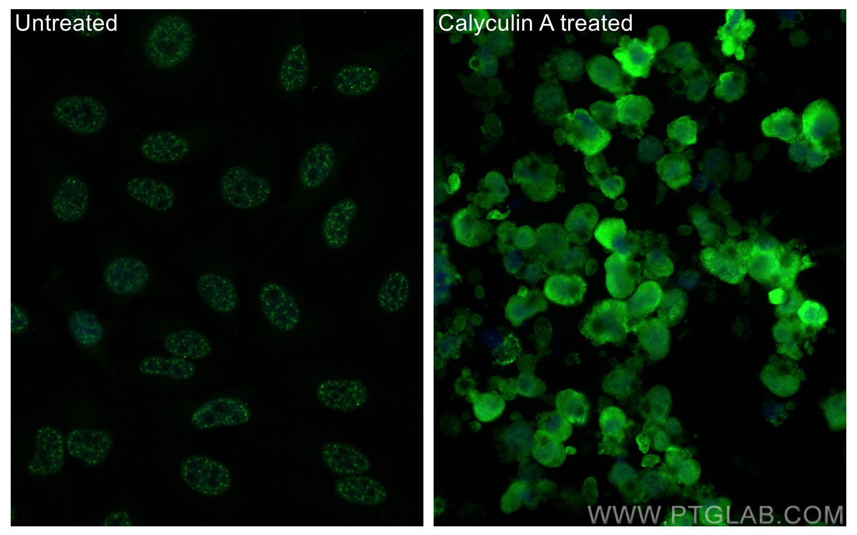 Phospho-Caspase 9 (Ser196)