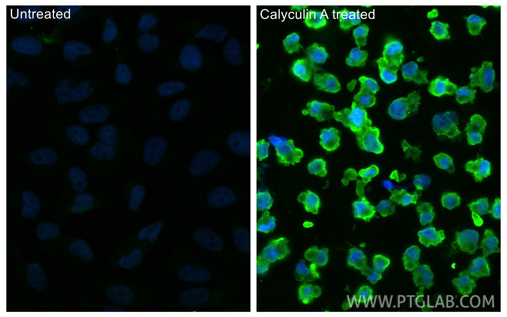 Immunofluorescence (IF) / fluorescent staining of HeLa cells using Phospho-Caspase 9 (Ser196) Recombinant monoclonal  (80346-1-RR)