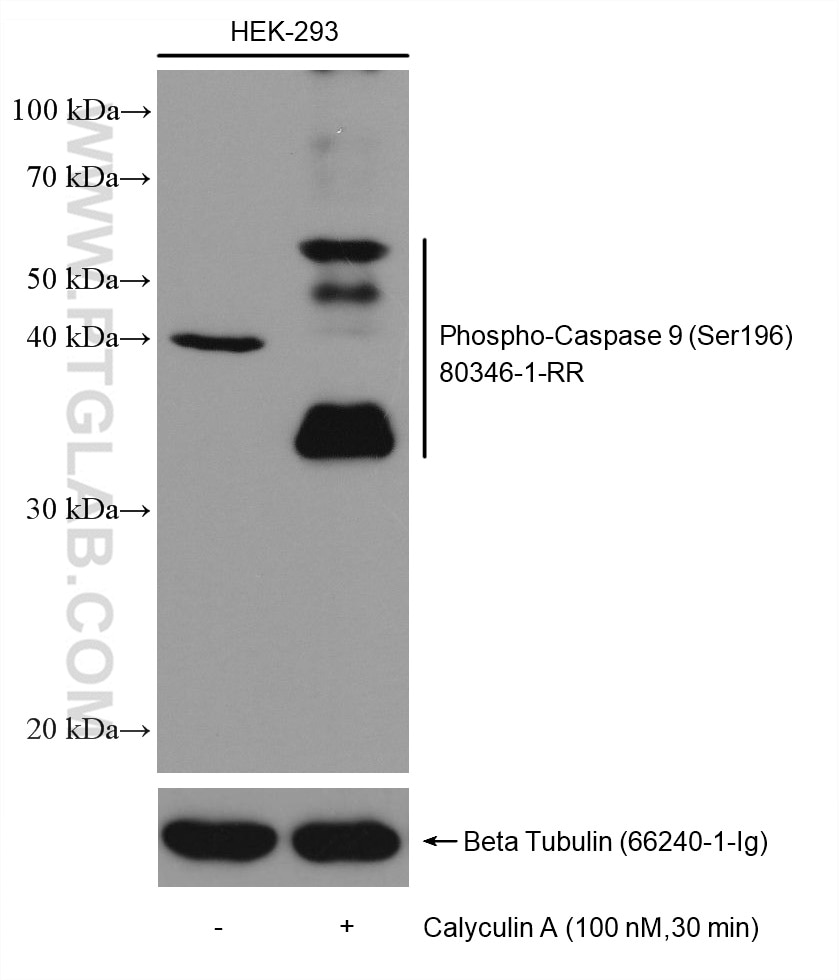 Western Blot (WB) analysis of various lysates using Phospho-Caspase 9 (Ser196) Recombinant antibody (80346-1-RR)