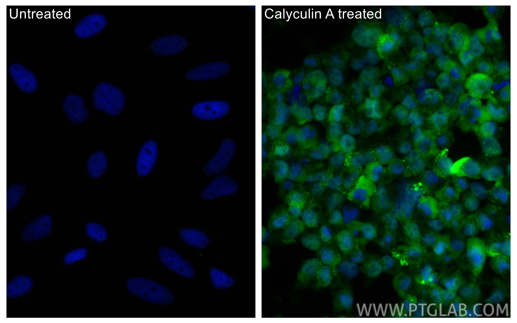 Immunofluorescence (IF) / fluorescent staining of HeLa cells using CoraLite® Plus 488-conjugated Phospho-Caspase 9 (S (CL488-80346)