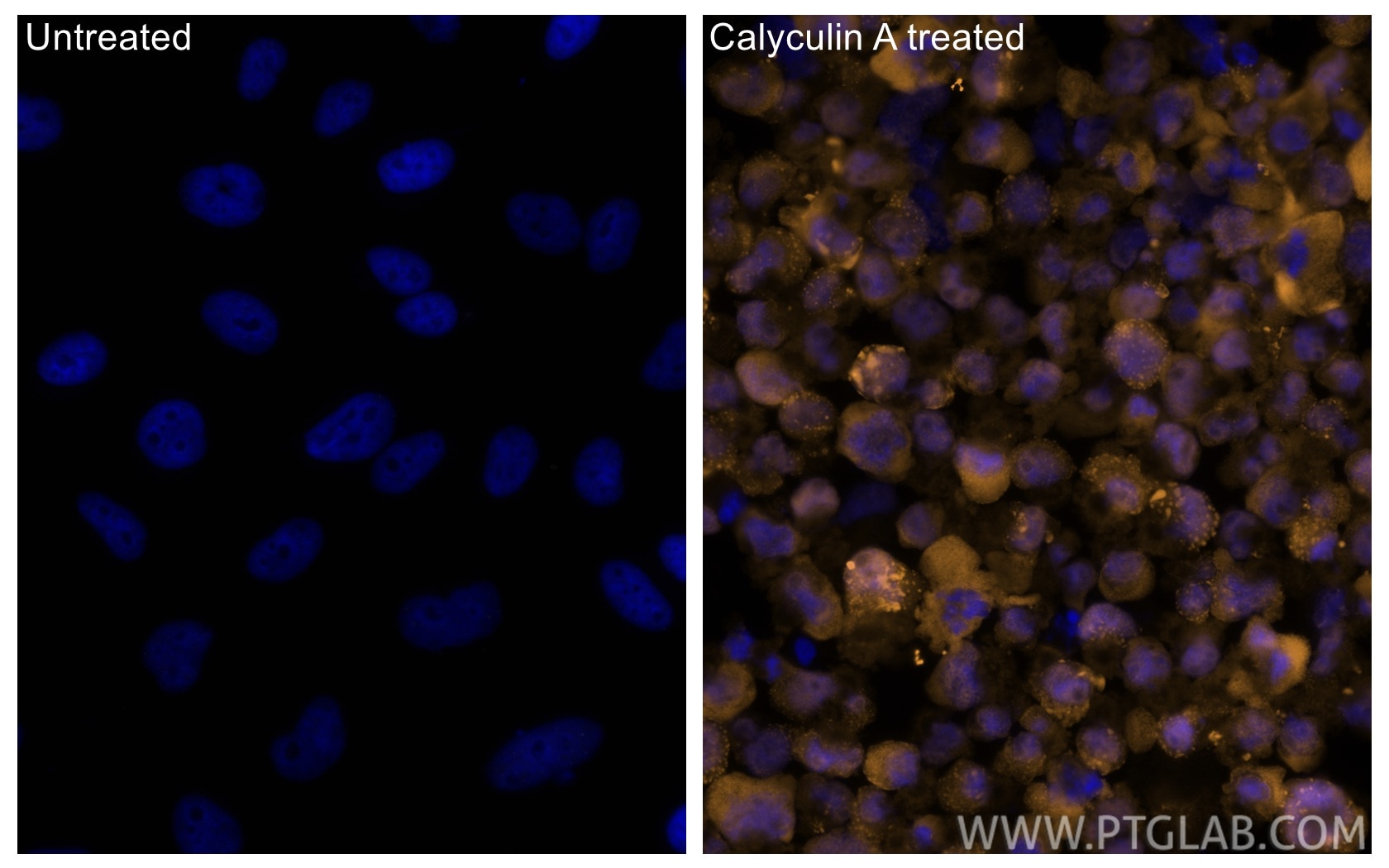 Immunofluorescence (IF) / fluorescent staining of HeLa cells using CoraLite®555-conjugated Phospho-Caspase 9 (Ser196) (CL555-80346)