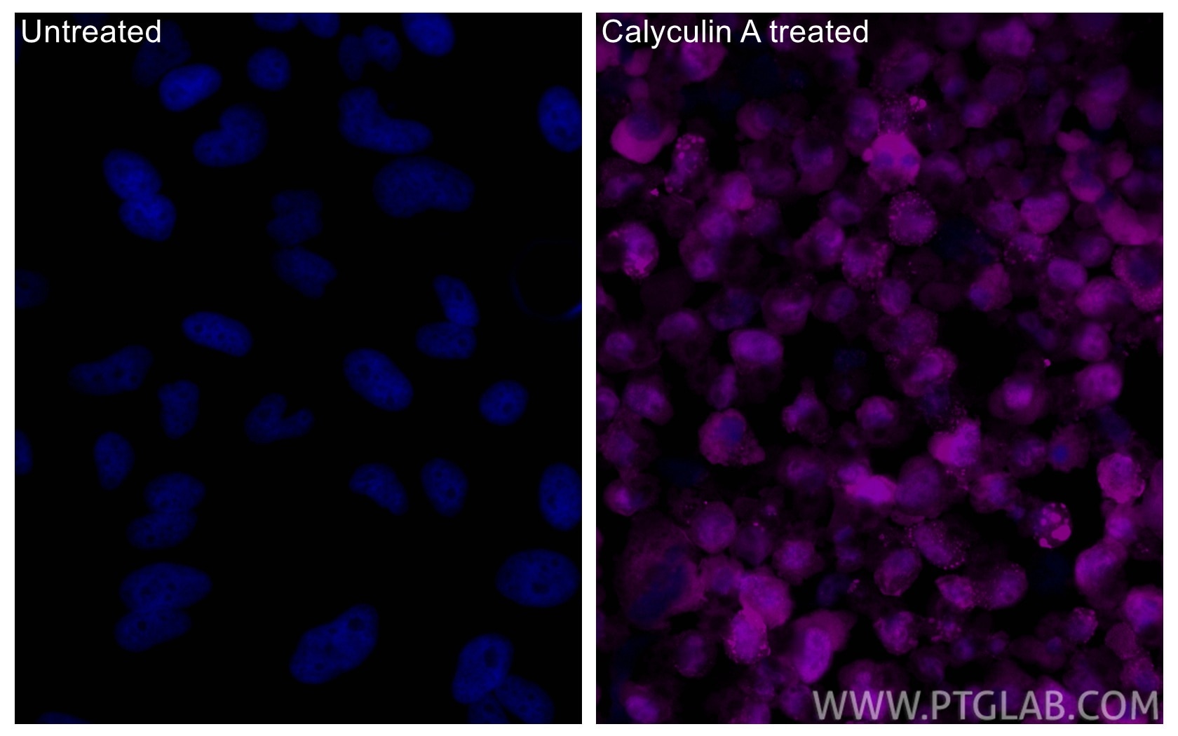 IF Staining of HeLa using CL647-80346 Immunofluorescence (IF) / fluorescent staining of HeLa cells using CoraLite® Plus 647-conjugated Phospho-Caspase 9 (S (CL647-80346)