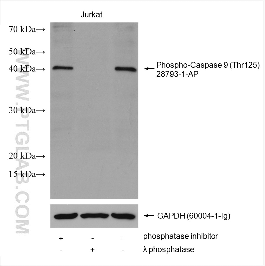 Western Blot (WB) analysis of various lysates using Phospho-Caspase 9 (Thr125) Polyclonal antibody (28793-1-AP)