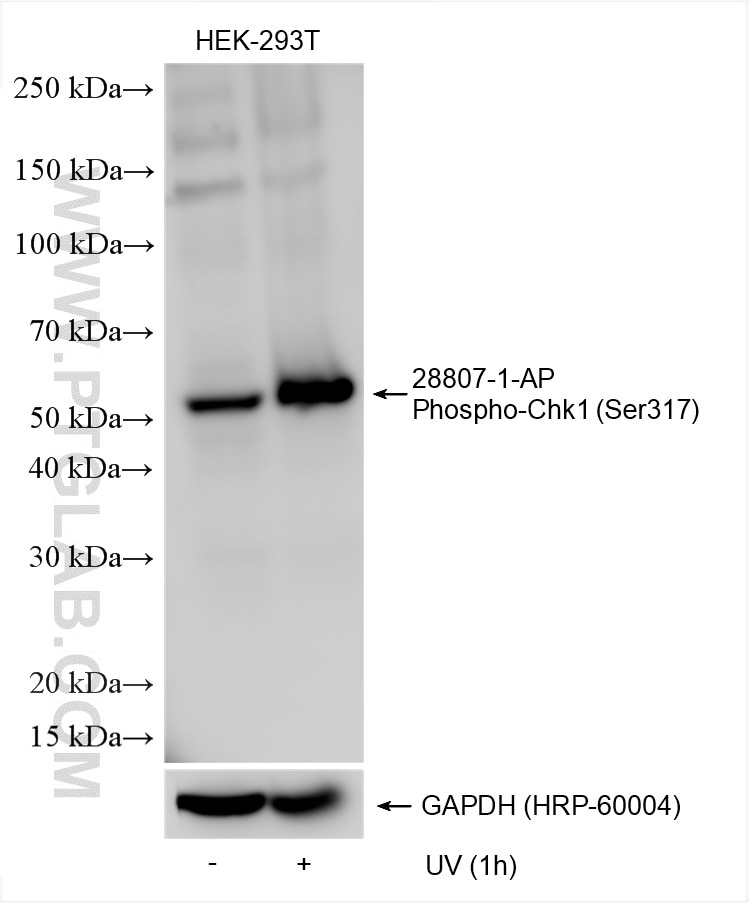 Western Blot (WB) analysis of various lysates using Phospho-Chk1 (Ser317) Polyclonal antibody (28807-1-AP)