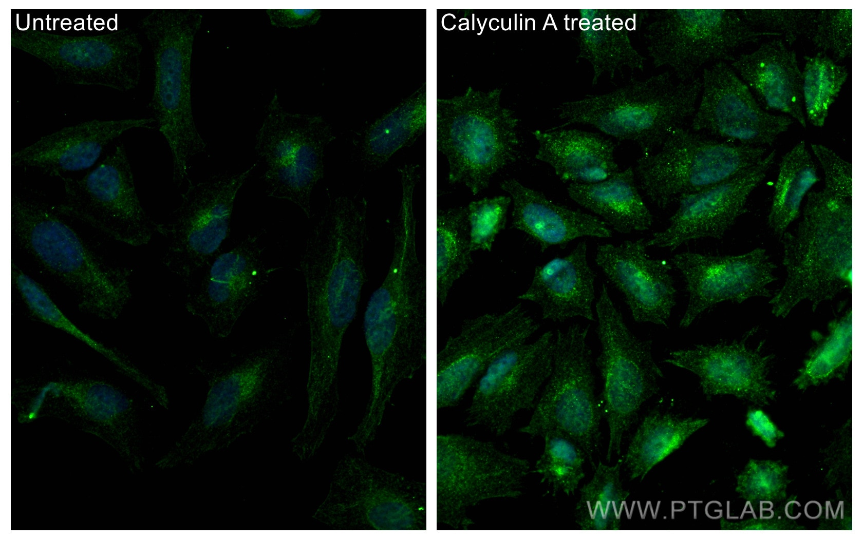 Immunofluorescence (IF) / fluorescent staining of HeLa cells using Phospho-Chk1 (Ser345) Polyclonal antibody (28803-1-AP)