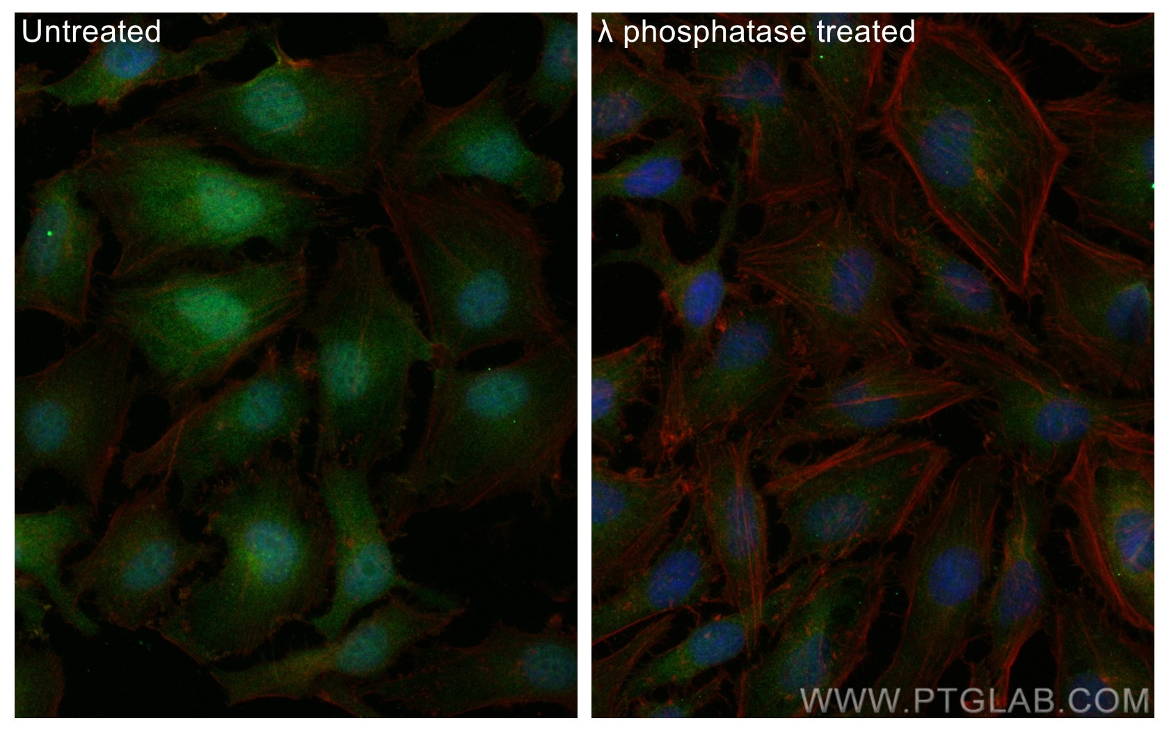 Immunofluorescence (IF) / fluorescent staining of HeLa cells using Phospho-Cofilin (Ser3) Polyclonal antibody (29715-1-AP)
