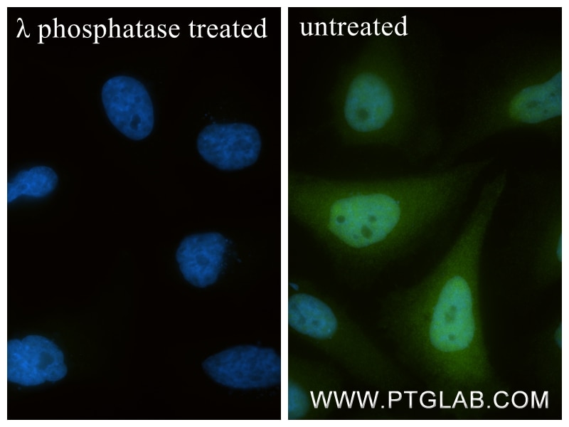 Immunofluorescent analysis of (4% PFA) fixed λ phosphatase treated Hela cells using Phospho-Cofilin (Ser3) antibody (86307-1-RR, Clone: 250986H5 ) at dilution of 1:400 and CoraLite®488-Conjugated Goat Anti-Rabbit IgG(H+L) (SA00013-2). Immunofluorescence (IF) / fluorescent staining of Hela cells using Phospho-Cofilin (Ser3) Recombinant monoclonal anti (86307-1-RR)