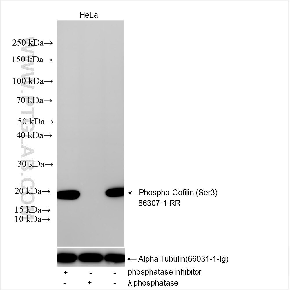 Non-treated HeLa cells, phosphatase inhibitor treated HeLa cells and λ phosphatase treated HeLa cells were subjected to SDS PAGE followed by western blot with 86307-1-RR (Phospho-Cofilin (Ser3) antibody) at dilution of 1:5000 incubated at room temperature for 1.5 hours. The membrane was stripped and re-blotted with Alpha Tubulin (66031-1-Ig) antibody as a loading control. Western Blot (WB) analysis of various lysates using Phospho-Cofilin (Ser3) Recombinant antibody (86307-1-RR)