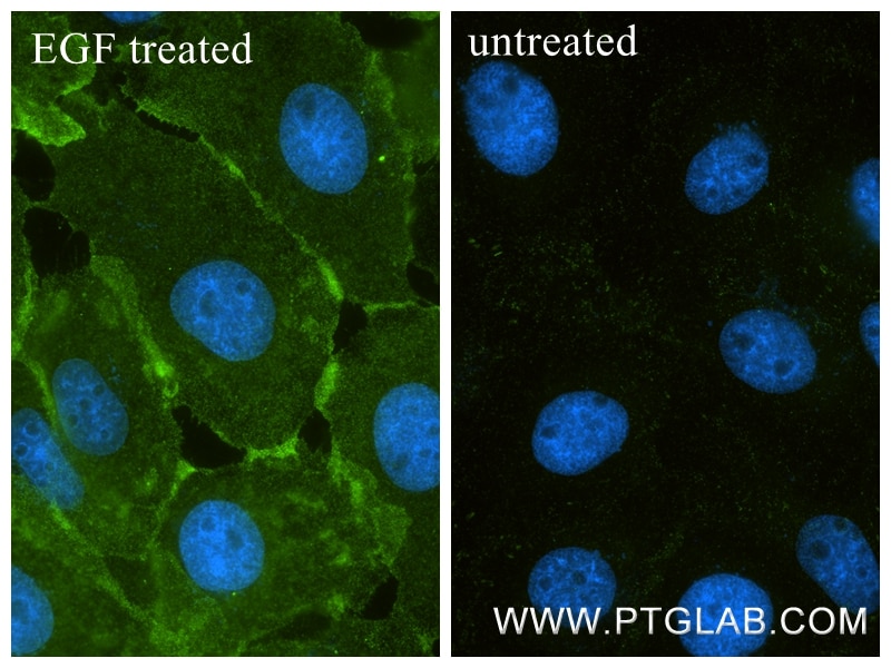 Immunofluorescence (IF) / fluorescent staining of A431 cells using Phospho-EGFR (Tyr1016) Recombinant monoclonal anti (82736-11-RR)