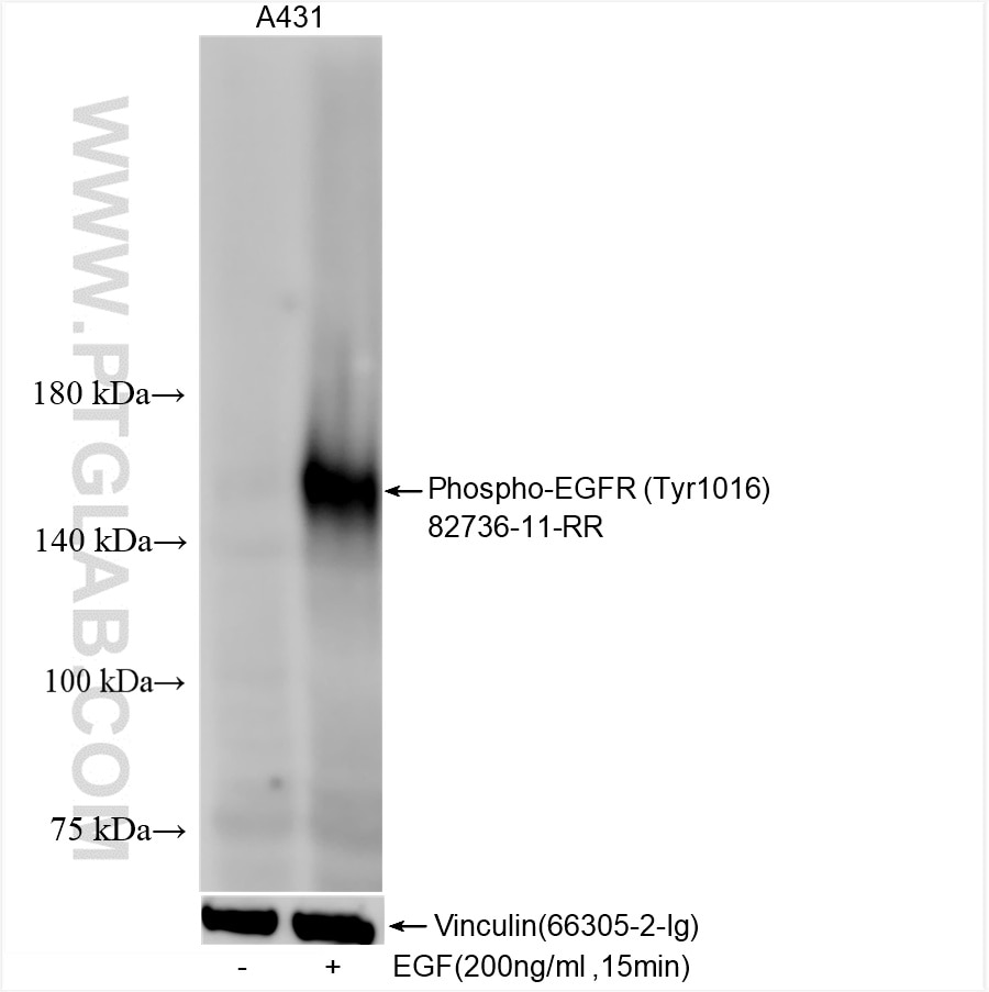 Western Blot (WB) analysis of A431 cells using Phospho-EGFR (Tyr1016) Recombinant antibody (82736-11-RR)