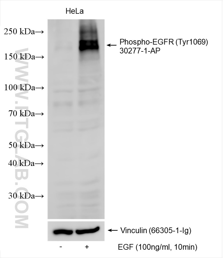 Western Blot (WB) analysis of various lysates using Phospho-EGFR (Tyr1069) Polyclonal antibody (30277-1-AP)