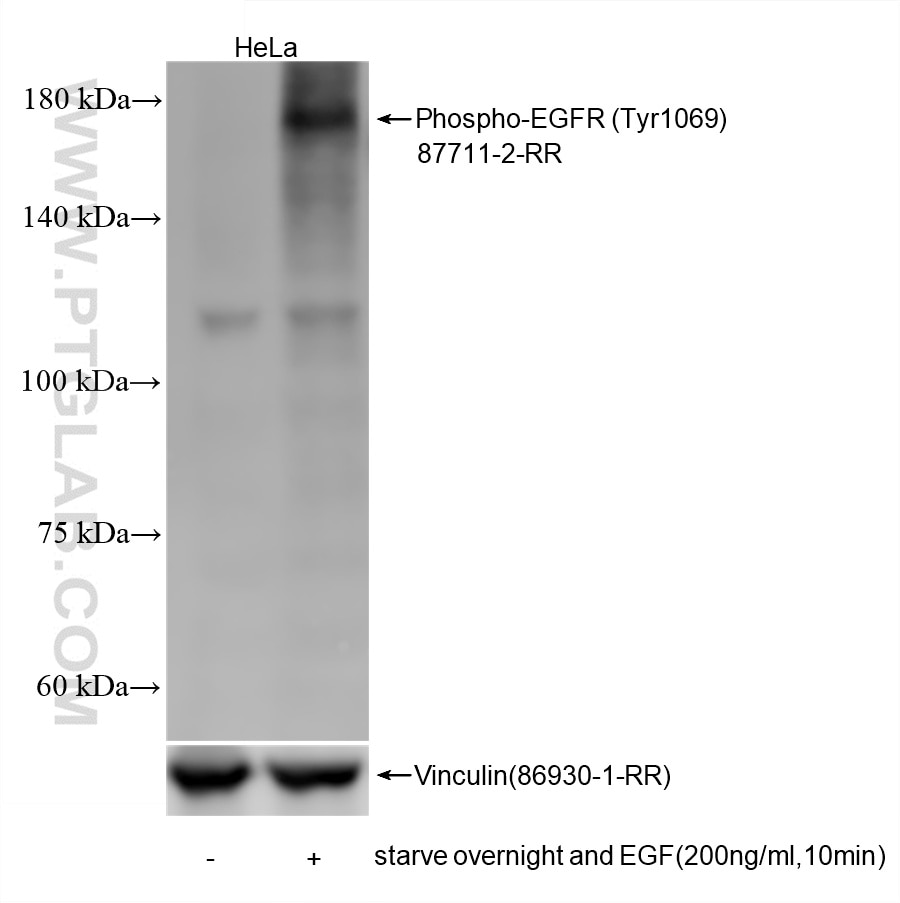 WB analysis using 87711-2-RR (same clone as 87711-2-PBS) Western Blot (WB) analysis of various lysates using Phospho-EGFR (Tyr1069) Recombinant monoclonal anti (87711-2-RR)