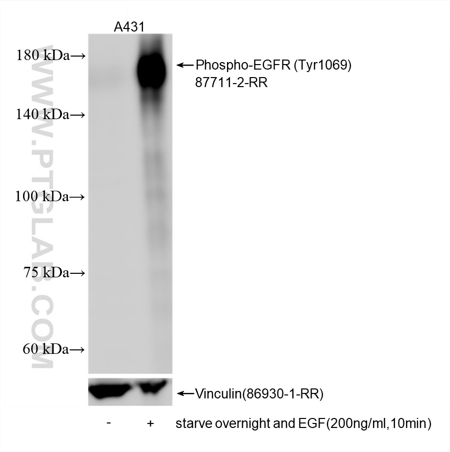 WB analysis using 87711-2-RR (same clone as 87711-2-PBS) Western Blot (WB) analysis of various lysates using Phospho-EGFR (Tyr1069) Recombinant monoclonal anti (87711-2-RR)