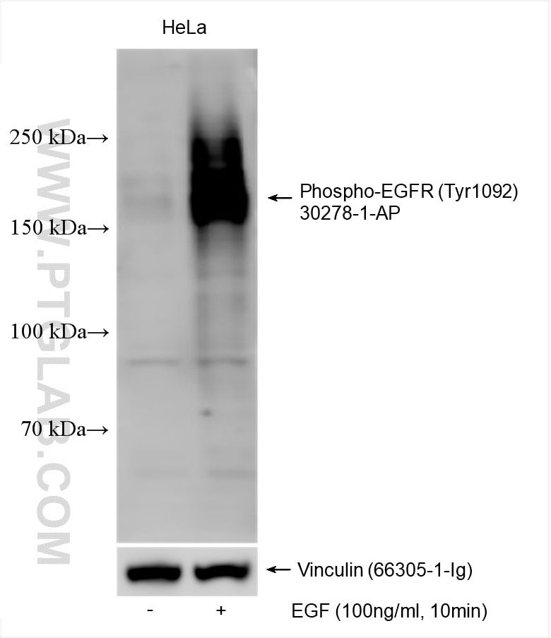 Western Blot (WB) analysis of various lysates using Phospho-EGFR (Tyr1092) Polyclonal antibody (30278-1-AP)