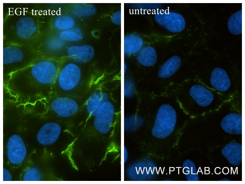 Immunofluorescence (IF) / fluorescent staining of A431 cells using Phospho-EGFR (Tyr1110) Recombinant monoclonal anti (87084-2-RR)