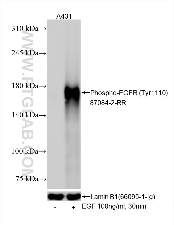 Western Blot (WB) analysis of various lysates using Phospho-EGFR (Tyr1110) Recombinant monoclonal anti (87084-2-RR)
