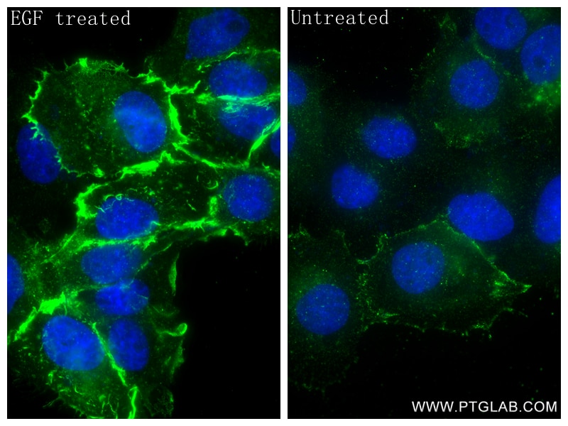 Immunofluorescent analysis of (4% PFA) fixed EGF treated A431 cells using Phospho-EGFR (Tyr1172) antibody (87164-1-RR, Clone: 252172E10 ) at dilution of 1:1000 and CoraLite®488-Conjugated Goat Anti-Rabbit IgG(H+L) (SA00013-2). This data was developed using the same antibody clone with 87164-1-PBS in a different storage buffer formulation. Immunofluorescence (IF) / fluorescent staining of A431 cells using Phospho-EGFR (Tyr1172) Recombinant monoclonal anti (87164-1-RR)