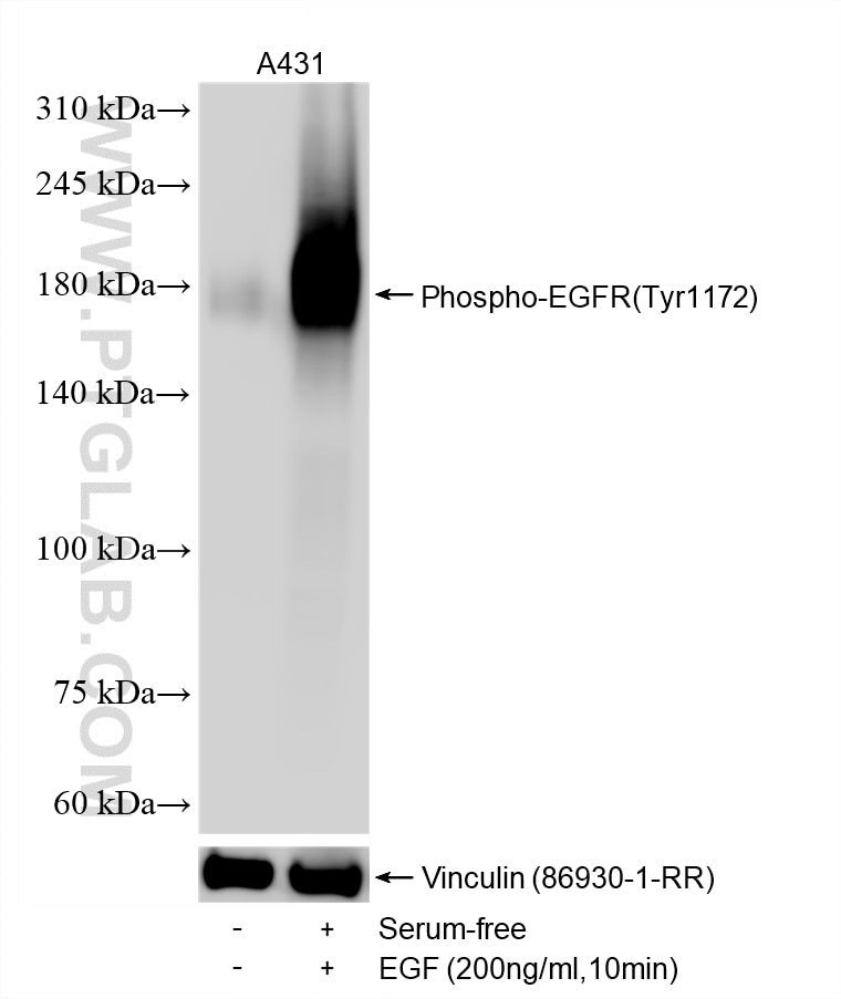 Non-treated A431 cells, Serum-free treated and EGF treated A431 cells were subjected to SDS PAGE followed by western blot with 87164-1-RR (Phospho-EGFR (Tyr1172) antibody) at dilution of 1:5000 incubated at room temperature for 1.5 hours. The membrane was stripped and re-blotted with Vinculin (86930-1-RR) antibody as a loading control. This data was developed using the same antibody clone with 87164-1-PBS in a different storage buffer formulation. Western Blot (WB) analysis of A431 cells using Phospho-EGFR (Tyr1172) Recombinant monoclonal anti (87164-1-RR)