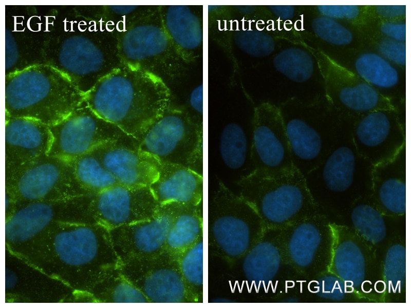 Immunofluorescent analysis of (4% PFA) fixed EGF treated A431 cells using Phospho-EGFR (Tyr1197) antibody (84906-1-RR, Clone: 241826G10 ) at dilution of 1:500 and CoraLite®488-Conjugated Goat Anti-Rabbit IgG(H+L) (SA00013-2). Immunofluorescence (IF) / fluorescent staining of A431 cells using Phospho-EGFR (Tyr1197) Recombinant monoclonal anti (84906-1-RR)