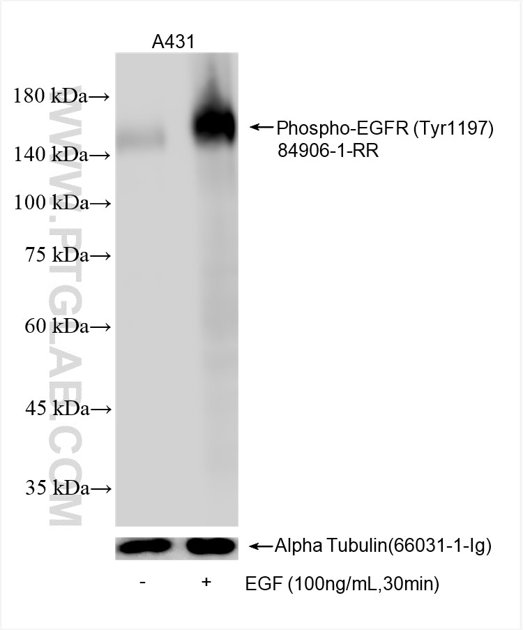Phospho-EGFR (Tyr1197)