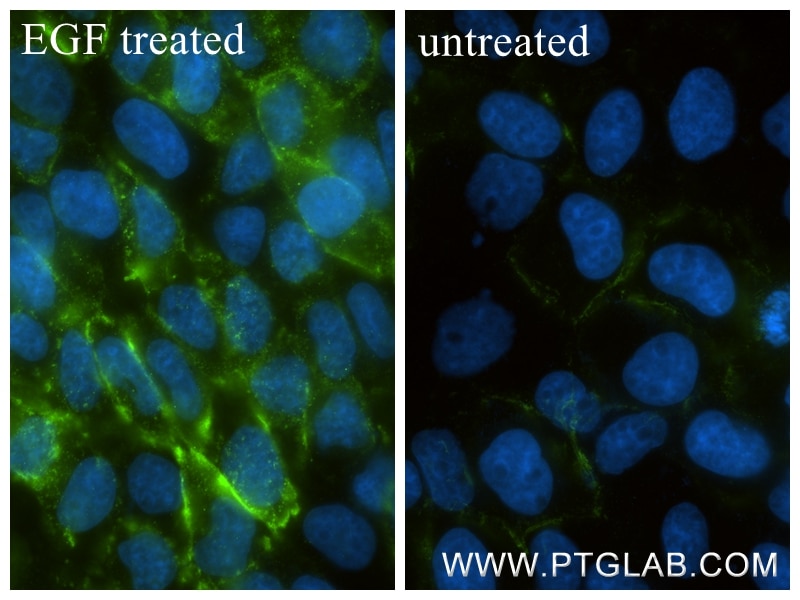 Immunofluorescent analysis of (4% PFA) fixed EGF treated A431 cells using Phospho-EGFR (Tyr869) antibody (84839-1-RR, Clone: 241785G5 ) at dilution of 1:800 and CoraLite®488-Conjugated Goat Anti-Rabbit IgG(H+L) (SA00013-2). Immunofluorescence (IF) / fluorescent staining of A431 cells using Phospho-EGFR (Tyr869) Recombinant monoclonal antib (84839-1-RR)