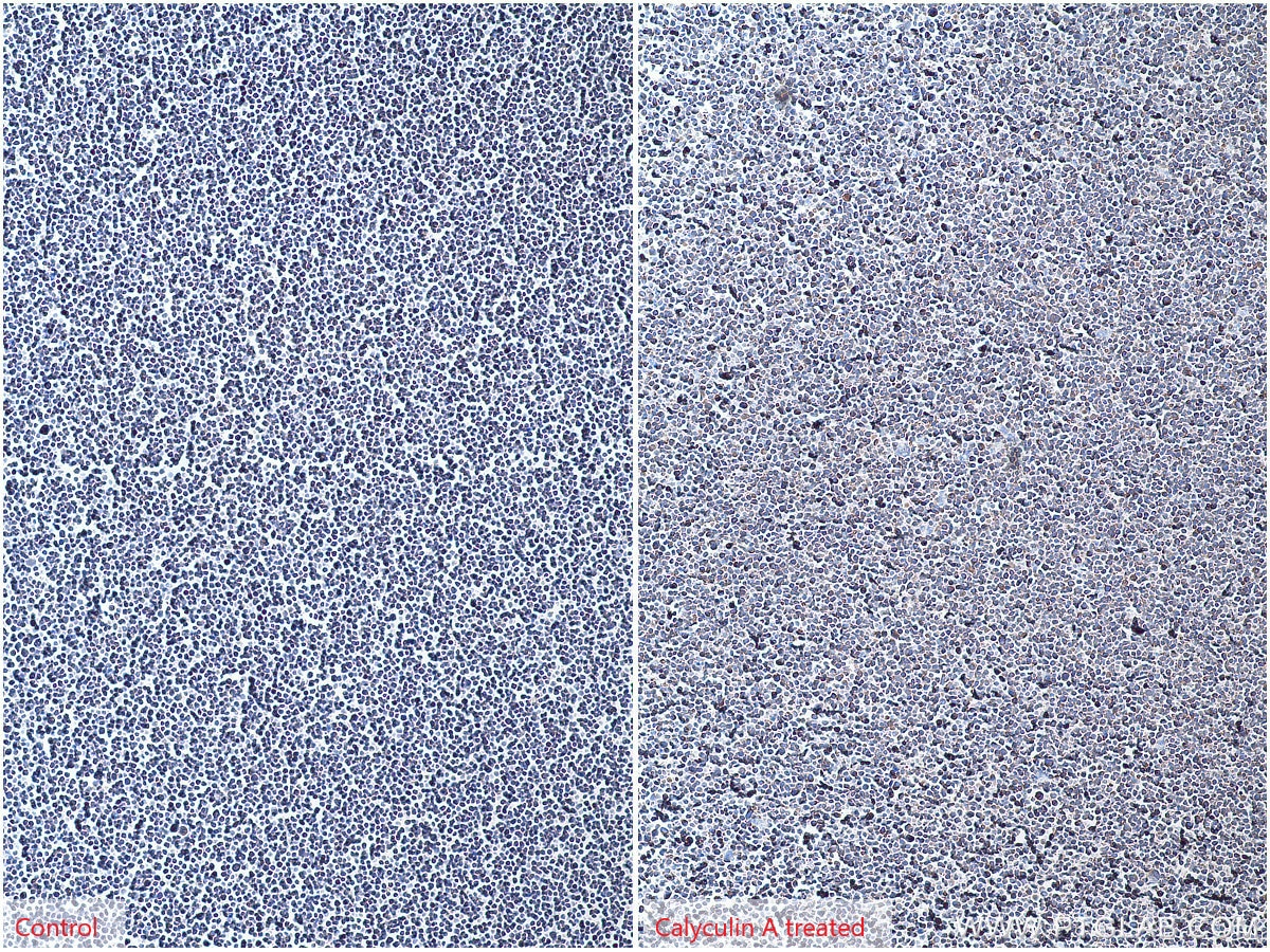 Immunohistochemistry (IHC) staining of Jurkat cells using Phospho-EIF2S1 (Ser51) Polyclonal antibody (28740-1-AP)
