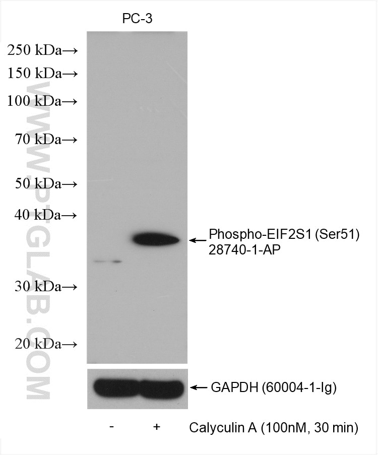 Western Blot (WB) analysis of various lysates using Phospho-EIF2S1 (Ser51) Polyclonal antibody (28740-1-AP)