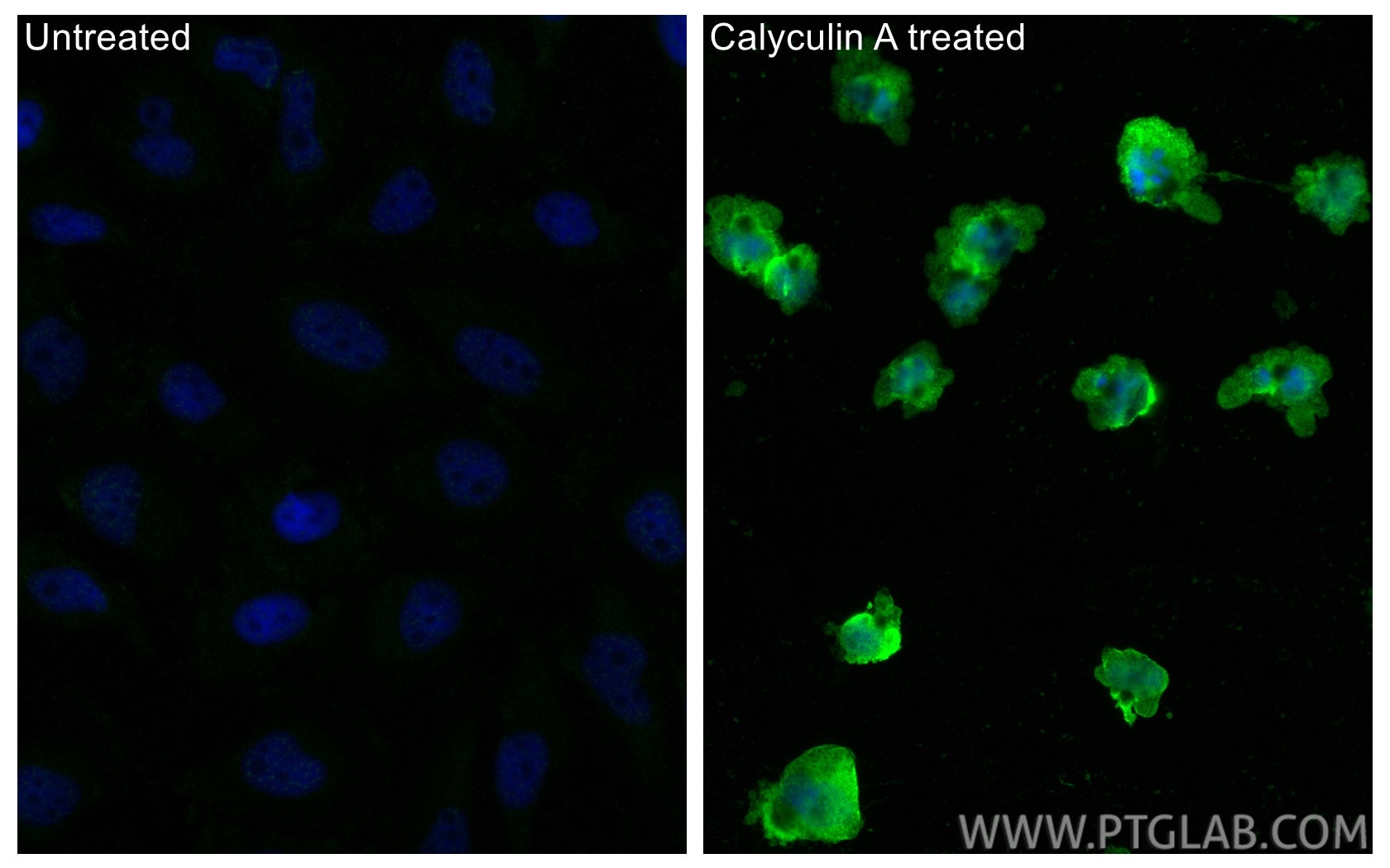 Immunofluorescence (IF) / fluorescent staining of HeLa cells using Phospho-EIF2S1 (Ser51) Monoclonal antibody (68023-1-Ig)