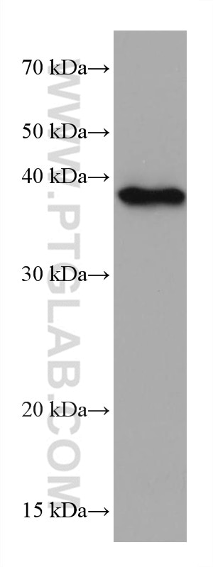 Western Blot (WB) analysis of HEK-293 cells using Phospho-EIF2S1 (Ser51) Monoclonal antibody (68023-1-Ig)