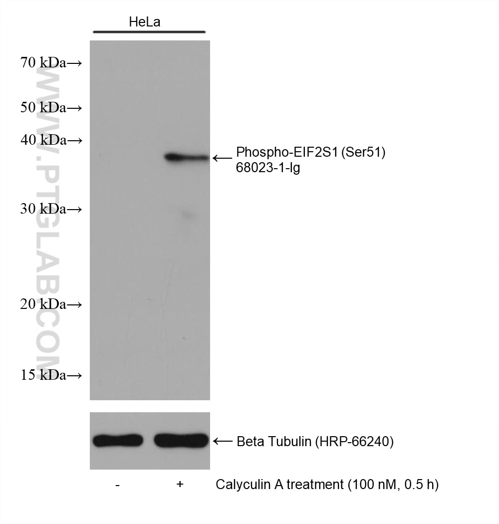 Western Blot (WB) analysis of various lysates using Phospho-EIF2S1 (Ser51) Monoclonal antibody (68023-1-Ig)