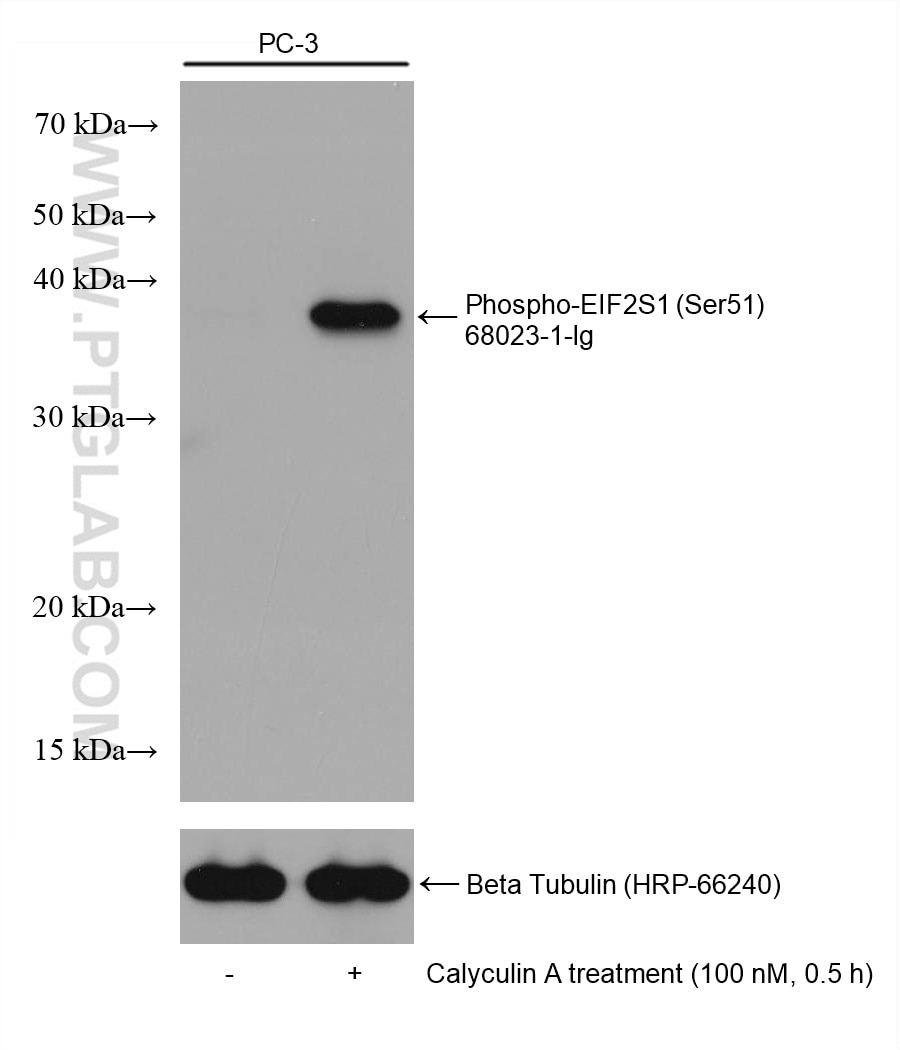 Western Blot (WB) analysis of various lysates using Phospho-EIF2S1 (Ser51) Monoclonal antibody (68023-1-Ig)