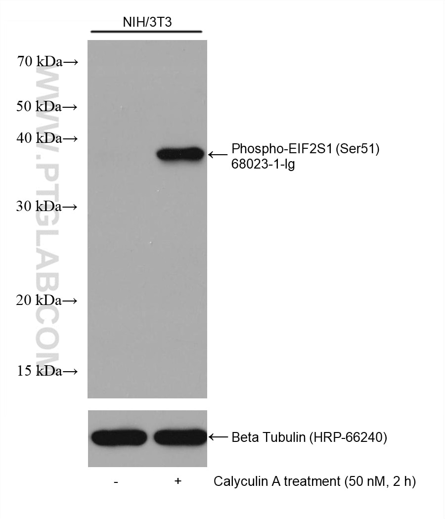 Western Blot (WB) analysis of various lysates using Phospho-EIF2S1 (Ser51) Monoclonal antibody (68023-1-Ig)