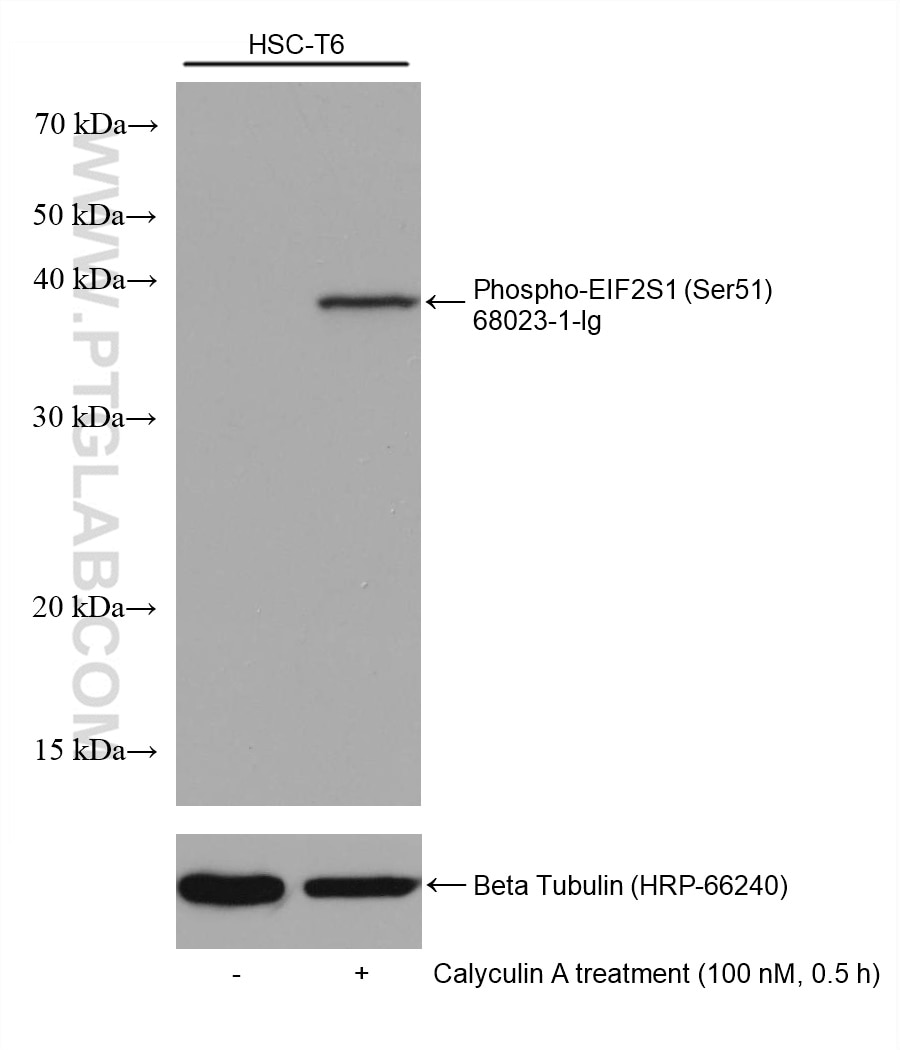Western Blot (WB) analysis of various lysates using Phospho-EIF2S1 (Ser51) Monoclonal antibody (68023-1-Ig)
