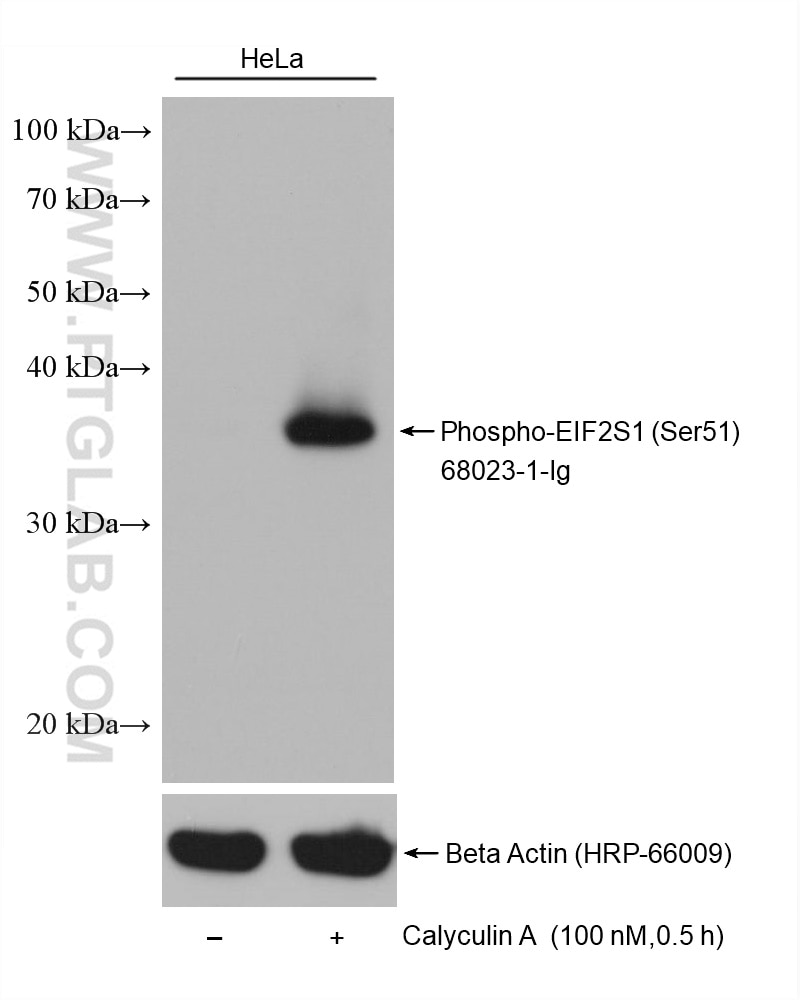 Western Blot (WB) analysis of various lysates using Phospho-EIF2S1 (Ser51) Monoclonal antibody (68023-1-Ig)