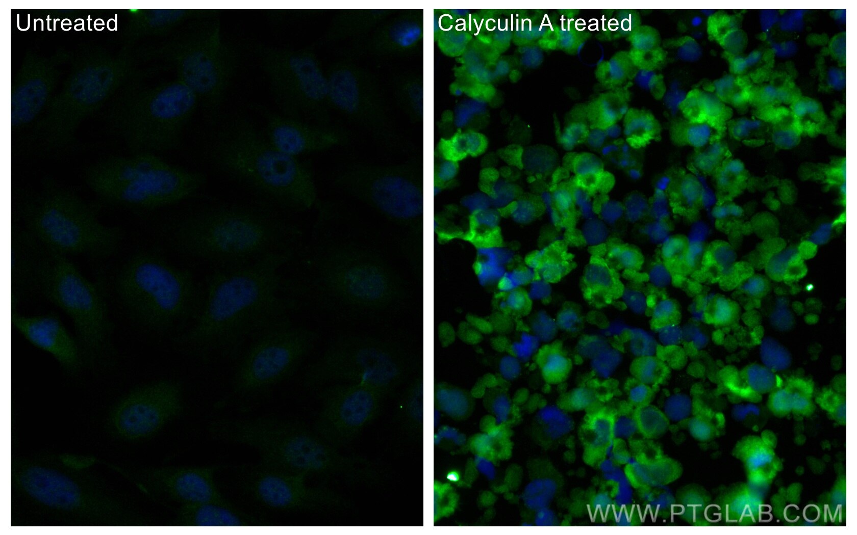 Immunofluorescence (IF) / fluorescent staining of HeLa cells using CoraLite® Plus 488-conjugated Phospho-EIF2S1 (Ser5 (CL488-68023)