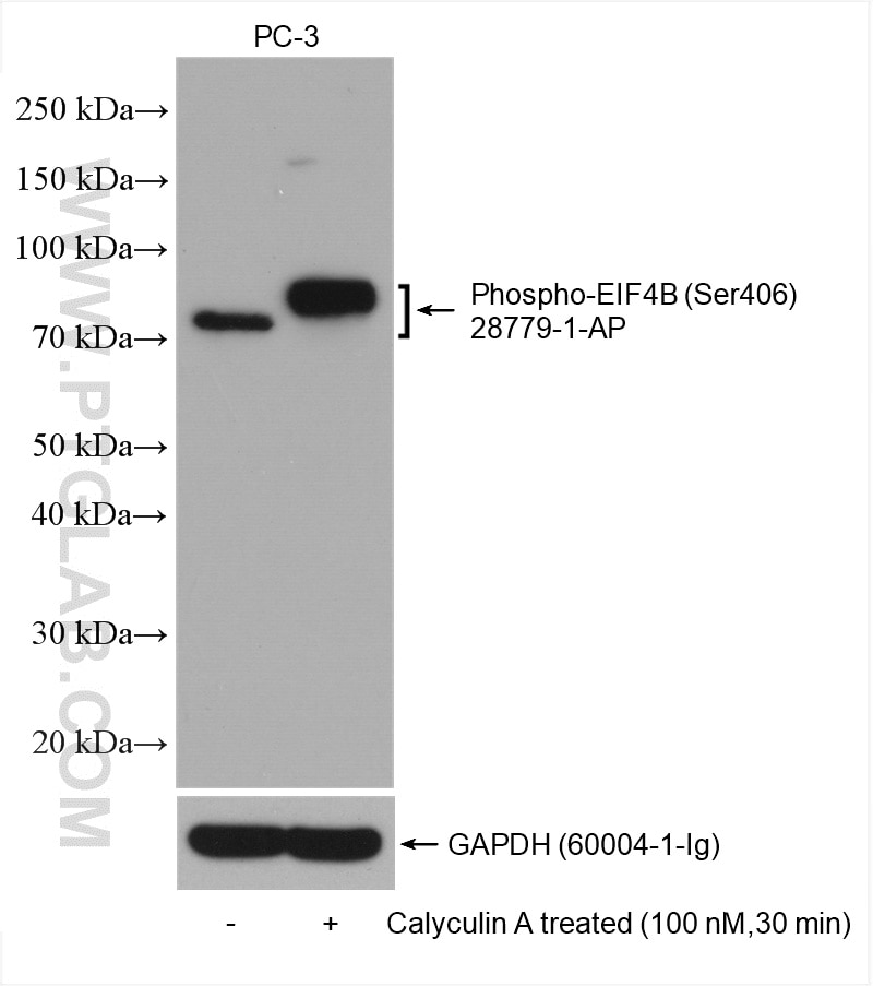 Western Blot (WB) analysis of various lysates using Phospho-EIF4B (Ser406) Polyclonal antibody (28779-1-AP)