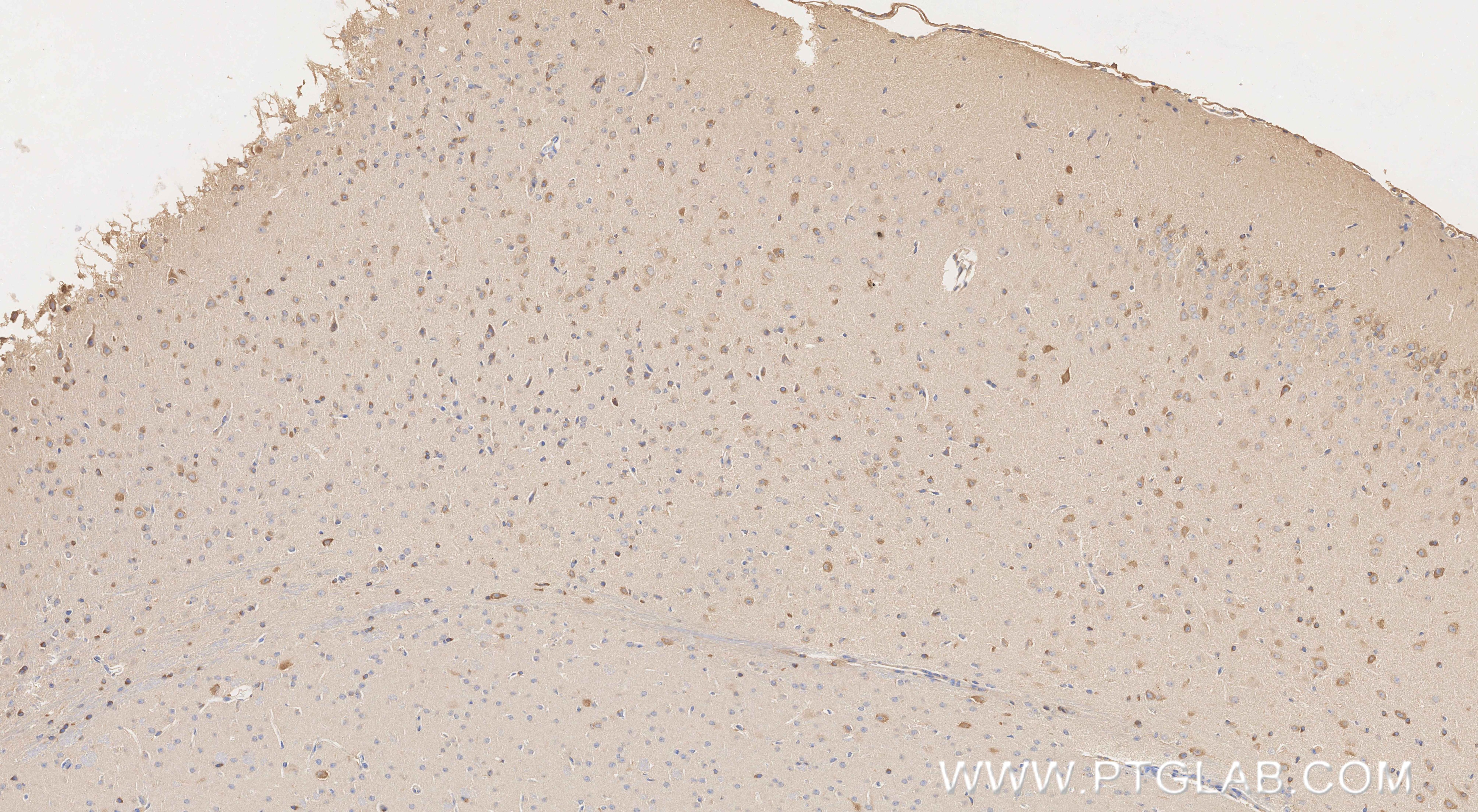 Immunohistochemistry (IHC) staining of mouse brain tissue using Phospho-EIF4B (Ser406) Recombinant monoclonal anti (80059-1-RR)