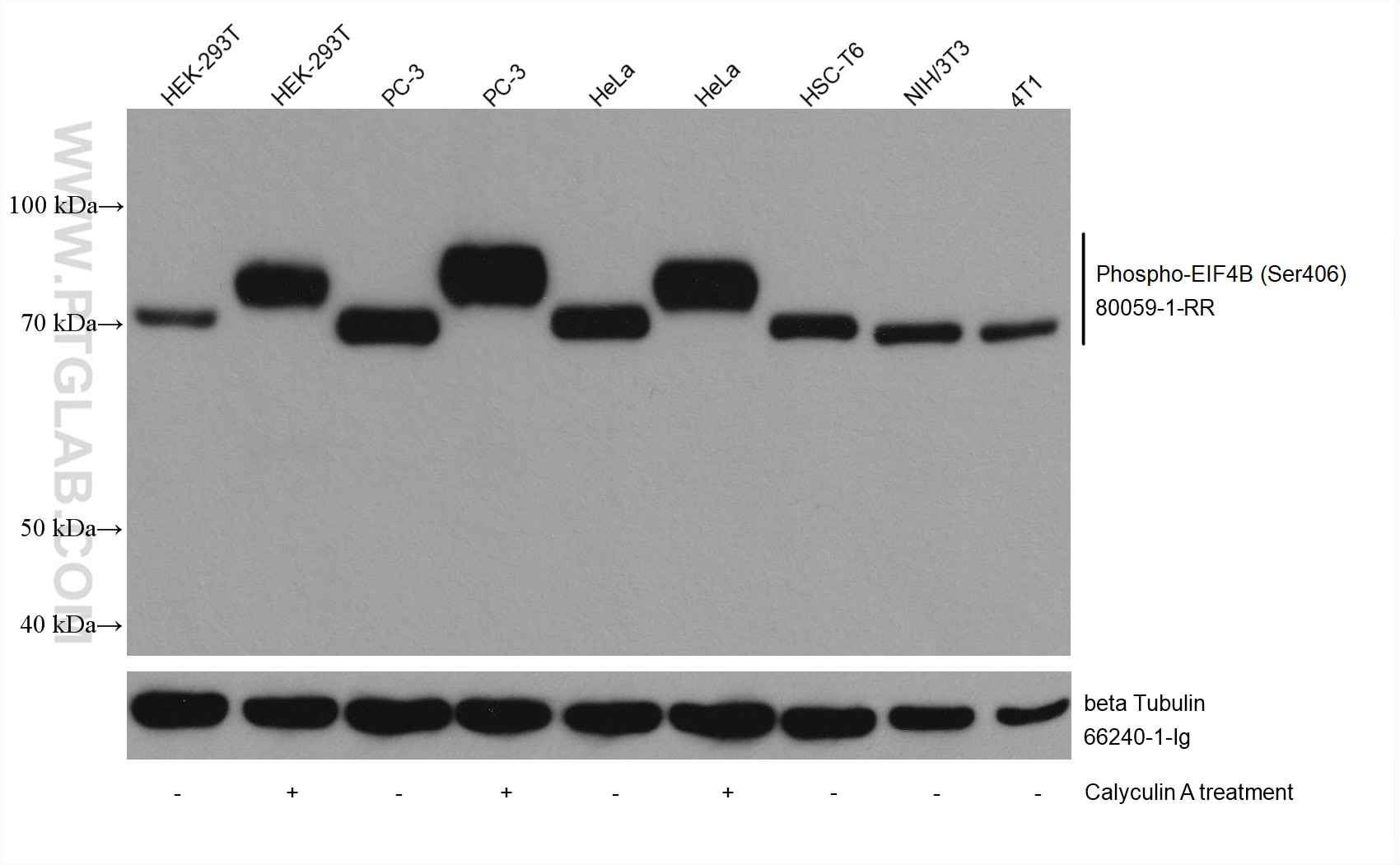 Western Blot (WB) analysis of various lysates using Phospho-EIF4B (Ser406) Recombinant antibody (80059-1-RR)
