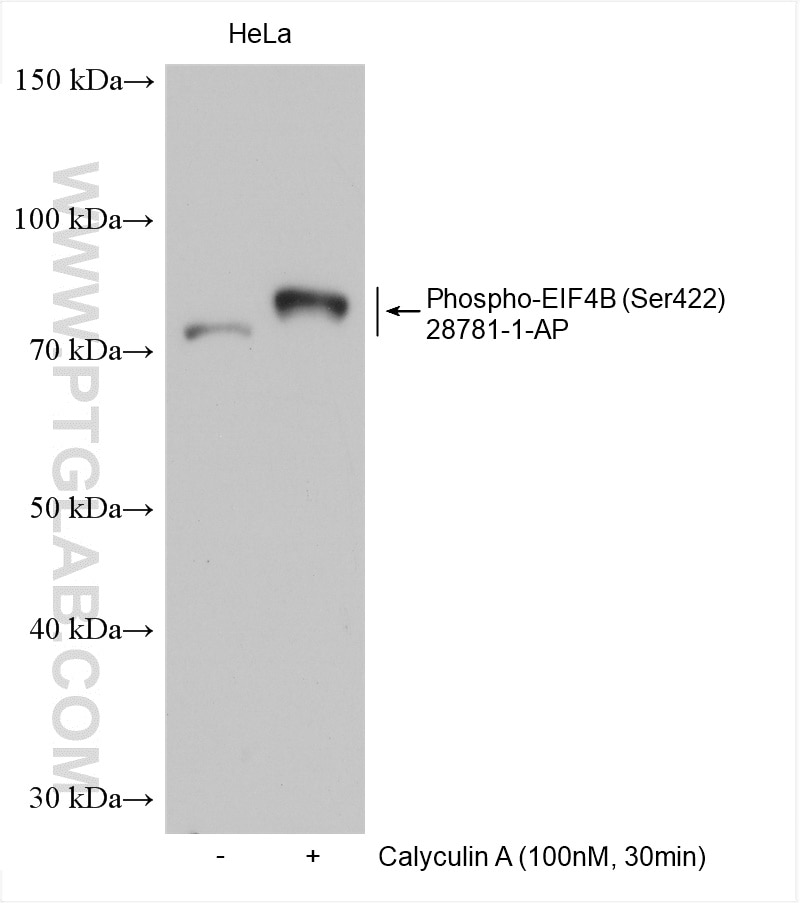 Western Blot (WB) analysis of various lysates using Phospho-EIF4B (Ser422) Polyclonal antibody (28781-1-AP)