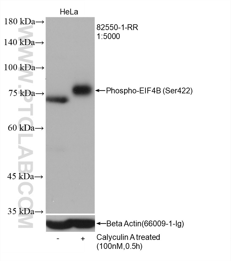 Western Blot (WB) analysis of various lysates using Phospho-EIF4B (Ser422) Recombinant antibody (82550-1-RR)