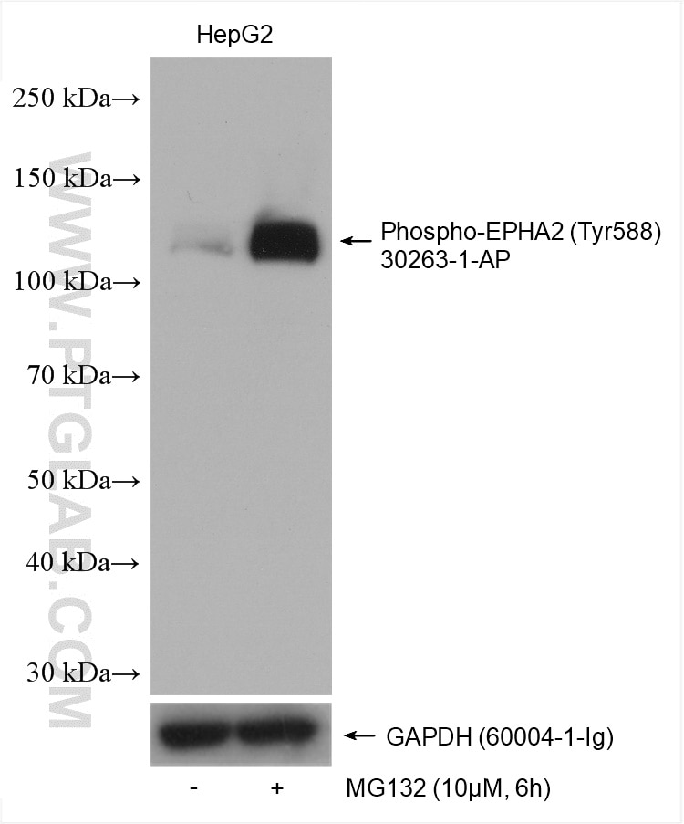 Western Blot (WB) analysis of various lysates using Phospho-EPHA2 (Tyr588) Polyclonal antibody (30263-1-AP)