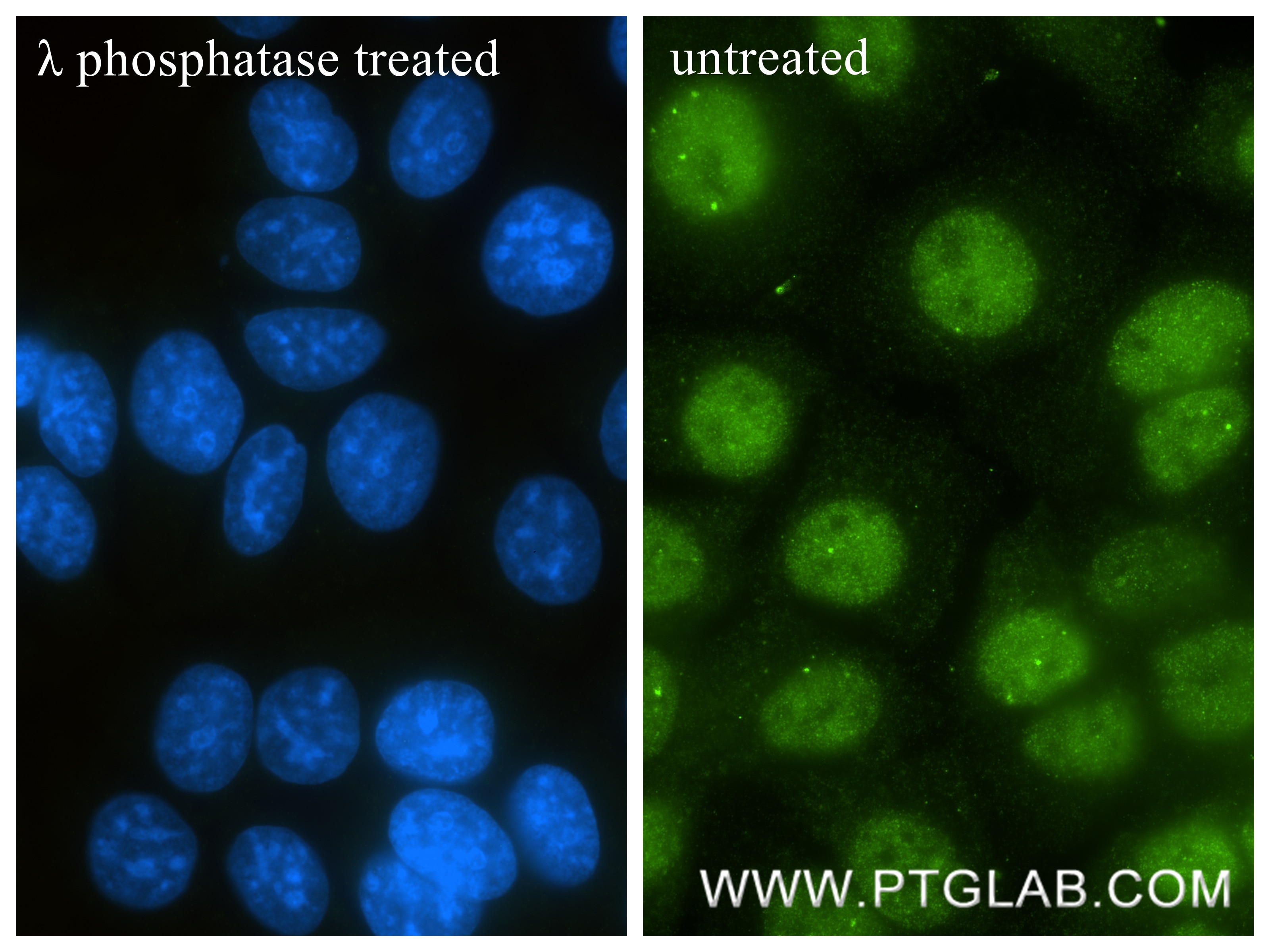 Immunofluorescence (IF) / fluorescent staining of MCF-7 cells using Phospho-Estrogen Receptor α (Ser118) Recombinant m (84564-6-RR)